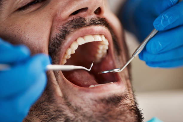 Best Mobile Emergency Dentist in Novato, CA